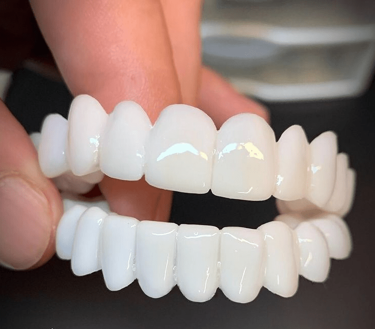 Dental Veneer Set | Snap Fit Tooth Cover Design-Dental-werune.com