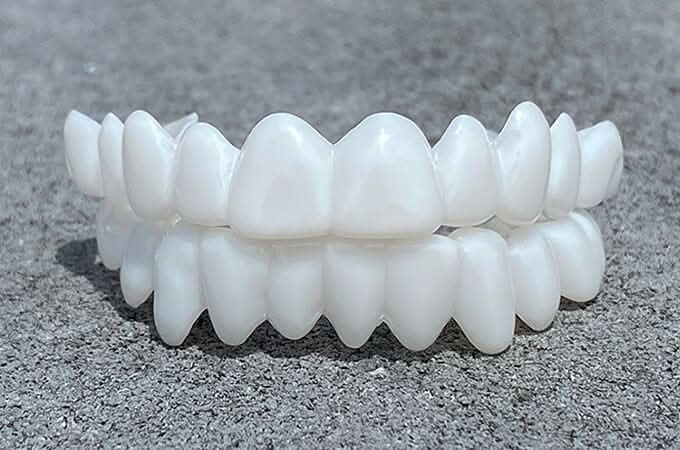 Dental Veneer Set | Snap Fit Tooth Cover Design-Dental-werune.com