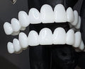 Dental Veneer Set | Snap Fit Tooth Cover Design-Dental-werune.com