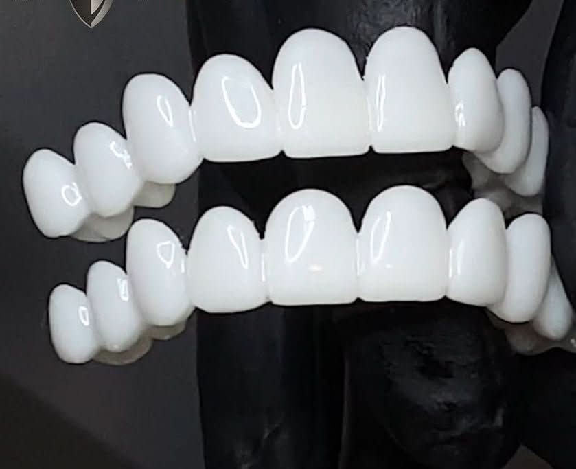 Dental Veneer Set | Snap Fit Tooth Cover Design-Dental-werune.com